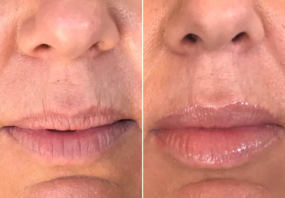 Lips